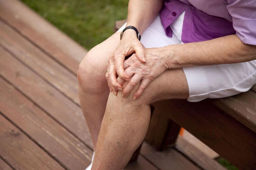 Η οστεοαρθρίτιδα του γόνατος είναι συχνή σε γυναίκες μεγαλύτερης ηλικίας
